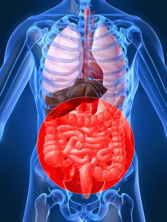 Disbioza intestinală provoacă activarea papilomavirusului uman